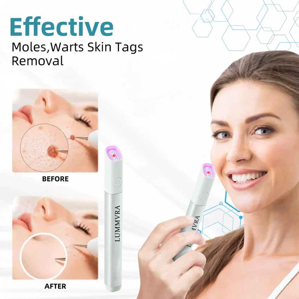 ✨ Lummvra™ All-in-One CO₂ Laser Eraser Pen | Removes Moles, Warts, Skin Flaws & Pigmentation