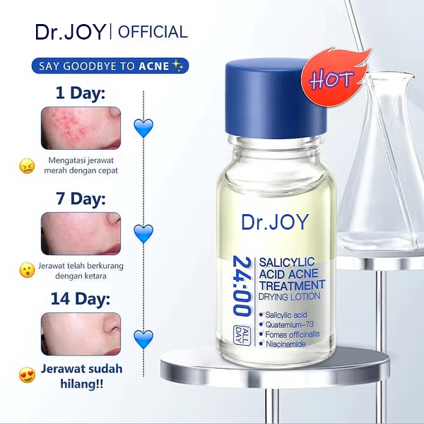 Salicylic Acid Acne Treatment Drying Lotion