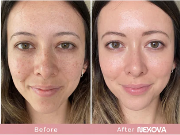 Eye Cream For Face And Neck Retinal, Peptide,Wrinkles, Fine Lines, Aging Skin