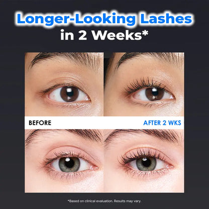 🔥Essential Eyelash Growth Serum, Jumbo Size 0.5fl.oz - Safe & Gentle Lashes Care, Fuller, Thicker in 2 Weeks, Non-Prostaglandin