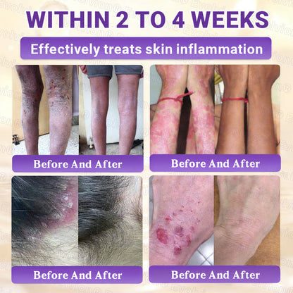 Made and Shipped from Canada ✨Lummvra® Biotin 10-in-1 Skin Restoration Cream