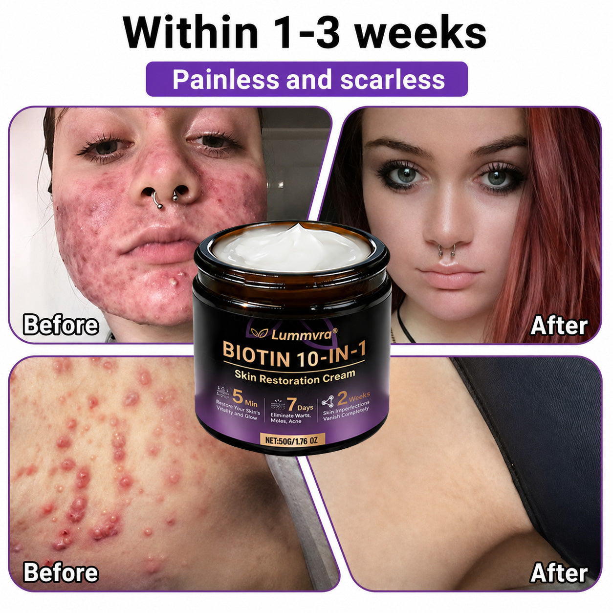 Made and Shipped from Canada ✨Lummvra® Biotin 10-in-1 Skin Restoration Cream