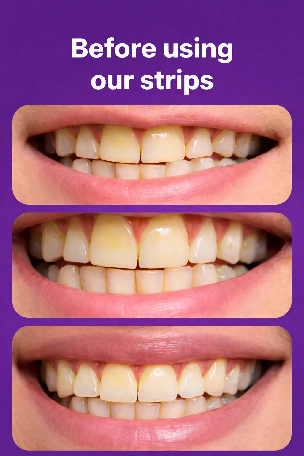 Dr.Purple™ Teeth Whitening Strips