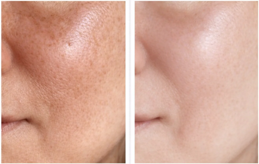 🌵Pore Relief Cooling Multi-Balm