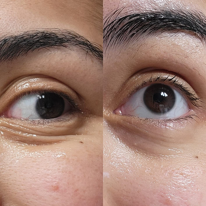 Eye Cream For Face And Neck Retinal, Peptide,Wrinkles, Fine Lines, Aging Skin
