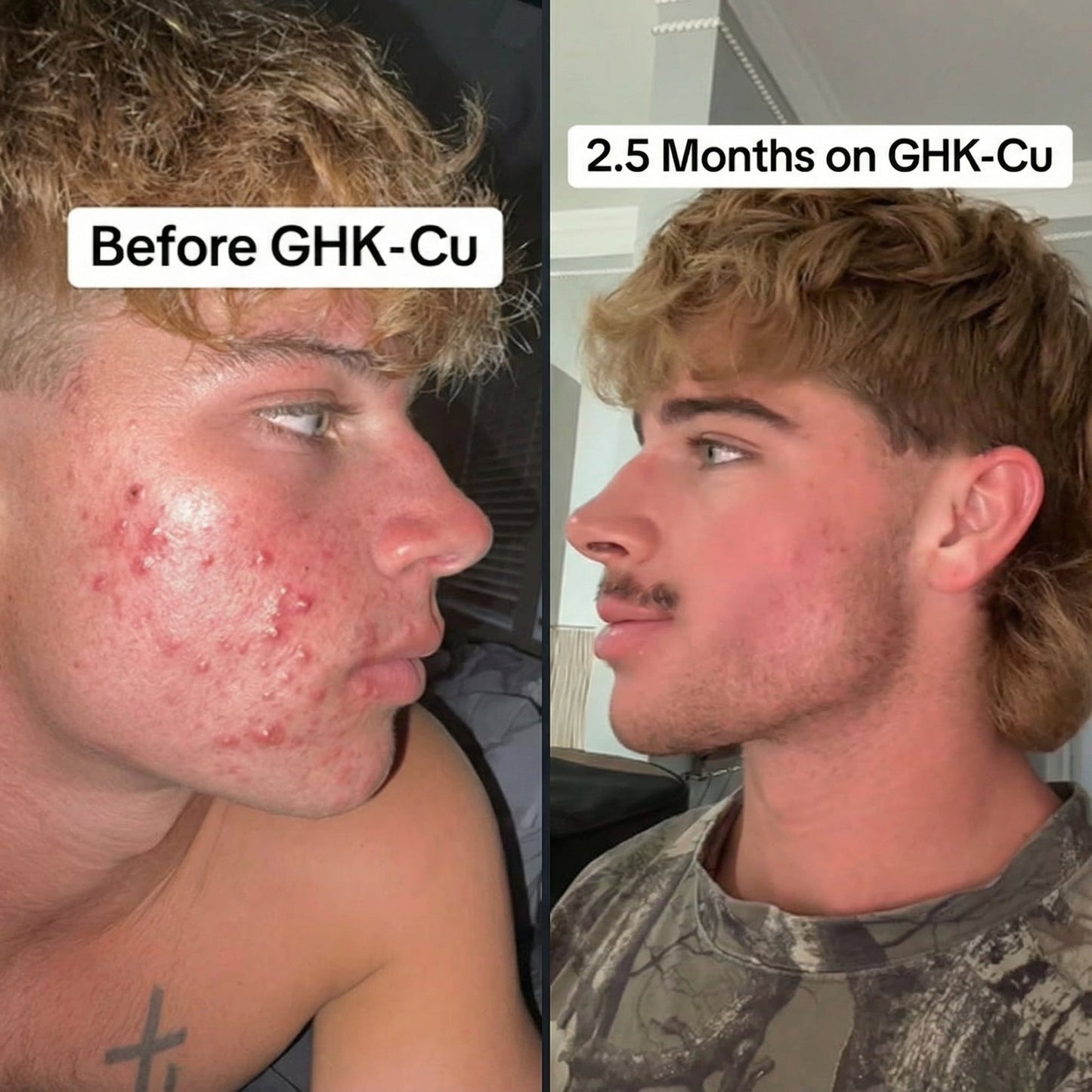 GHK-Cu and Hyaluronic Acid Anti-Aging Facial Serum